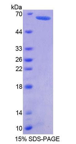 Human Geminin Protein (Recombinant His-GST)