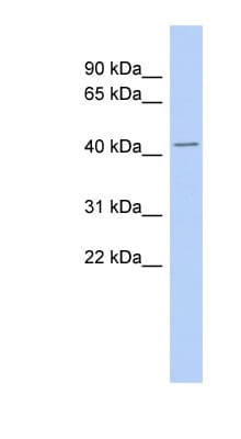 Polyclonal Rabbit anti-Human TMPO / TP / Thymopoietin Antibody (aa143-192, WB)
