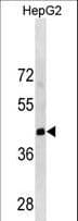 Polyclonal Rabbit anti-Human LRRC19 Antibody (aa289-318, WB)
