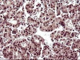 UPRT Antibody (clone OTI3A3, Carrier-free)