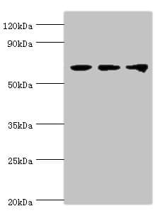 Polyclonal Rabbit anti-Human DDX5 Antibody (aa1-290, IHC, WB)