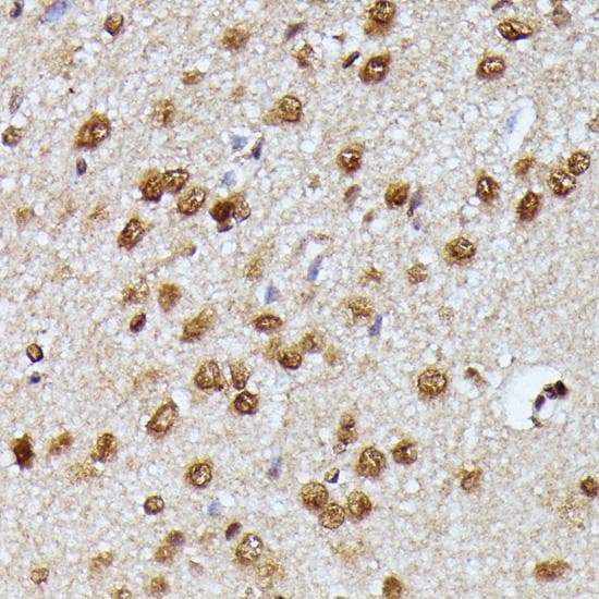 Polyclonal Rabbit anti-Human KIAA1429 Antibody (IHC)
