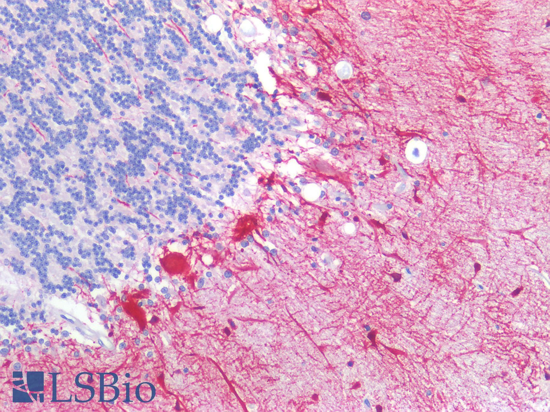 PathPlus™ SLC6A8 Antibody (aa359-408)