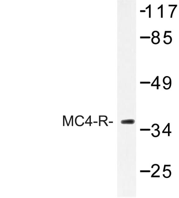 MC4R / Melanocortin 4 Receptor Antibody (Glu315)
