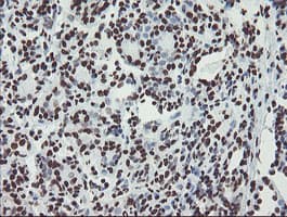 NONO / P54NRB Antibody (aa184-385, clone OTI5F1)