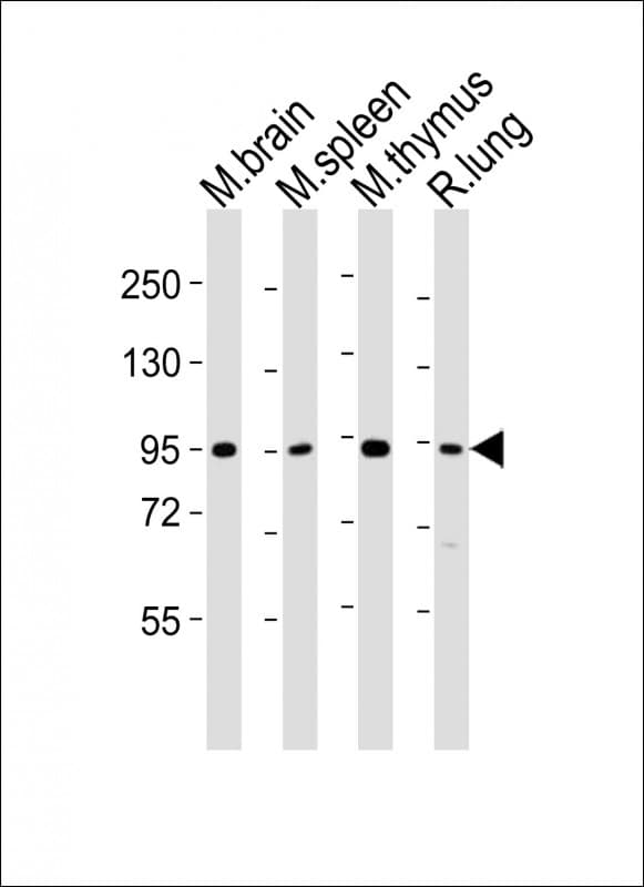 Polyclonal Rabbit anti-Mouse MED15 / ARC105 Antibody (aa712-746, WB)