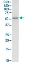 IHC-plus™ NEU1 / NEU Antibody (clone 3F9)
