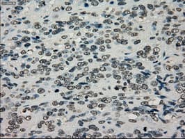 TYRO3 Antibody (clone OTI5B4)