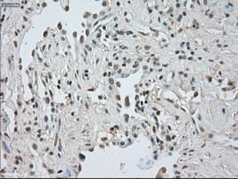 CTAG1B / NY-ESO-1 Antibody (clone OTI2B6)