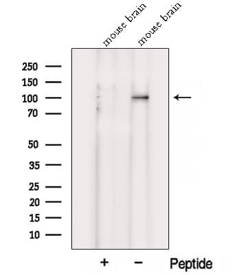 VPS39 Antibody