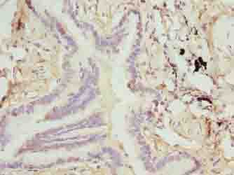 Polyclonal Rabbit anti-Human TTLL6 Antibody (IHC)