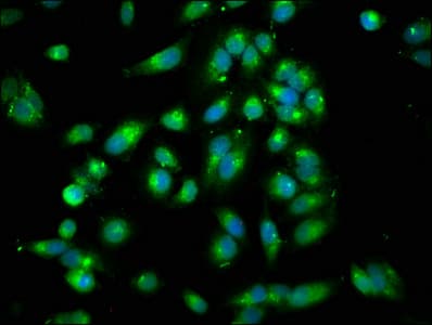 IHC-plus™ ARHGEF7 Antibody
