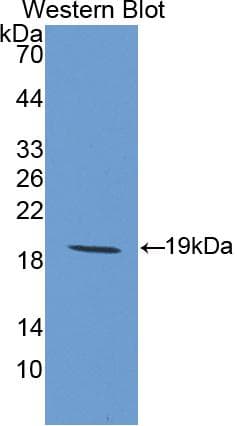 IL1RN Antibody (aa26-177)