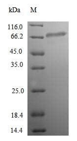 Human ACSS1 Protein (Recombinant 6His, N-terminus)