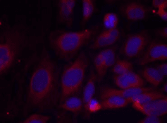NFKB1 / NF-Kappa-B Antibody