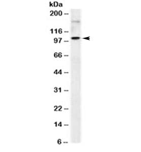 Monoclonal Mouse anti-Human ICAM-1 / CD54 Antibody (clone 1H4 or W-CAM-1 or Wehi-CAM-1, IHC, IF, WB)