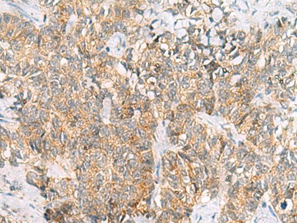 TUFT1 Antibody