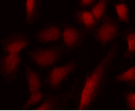 GATA1 Antibody