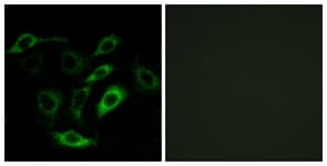 IHC-plus™ Polyclonal Rabbit anti-Human Prostaglandin D2 Receptor Antibody (aa263-312, IHC, IF, WB)