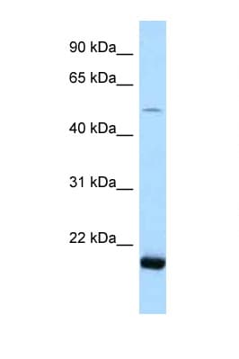 SARS2 / SYS Antibody (aa108-157)