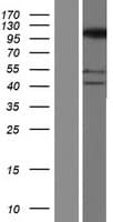 SFMBT2 Protein (Over-Expression Lysate Myc-DDK (Flag))