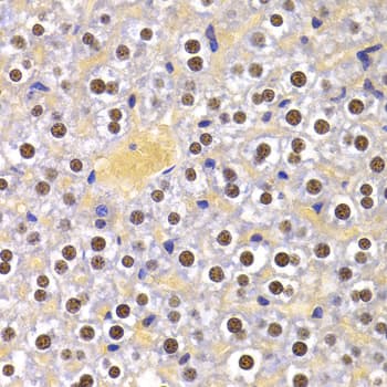 PPP1R8 / Rnase E Antibody