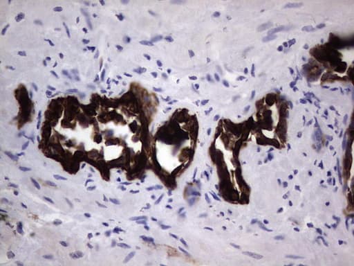 Monoclonal Mouse anti-Human KRT19 / CK19 / Cytokeratin 19 Antibody (clone OTI6E8, aa240-390, IHC)