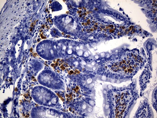 CD74 / CLIP Antibody (clone UMAB231)