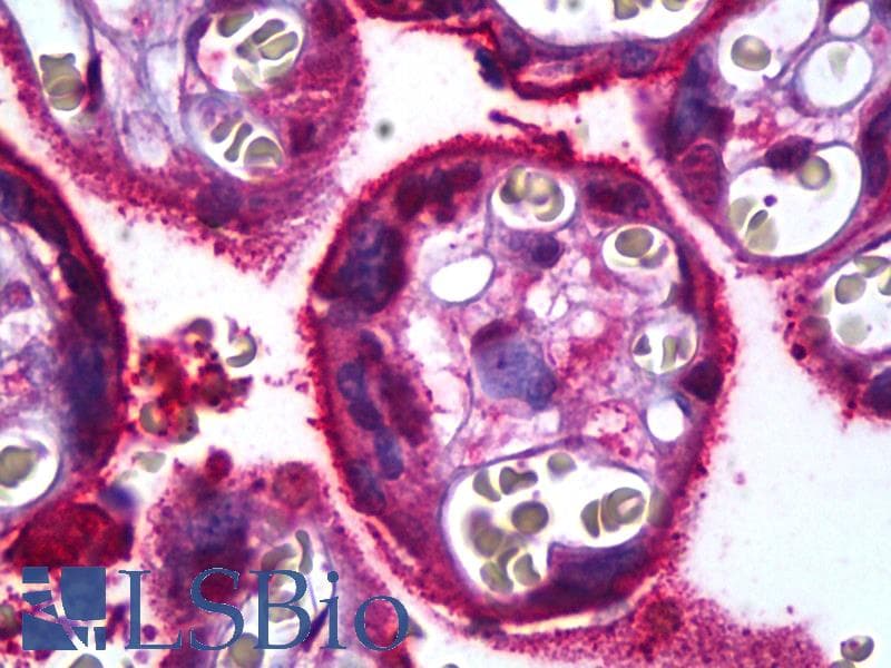 IHC-plus™ SDC1 / Syndecan 1 / CD138 Antibody