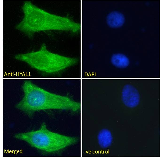 IHC-plus™ Polyclonal Goat anti-Human HYAL1 Antibody (aa325-339, IHC, IF)