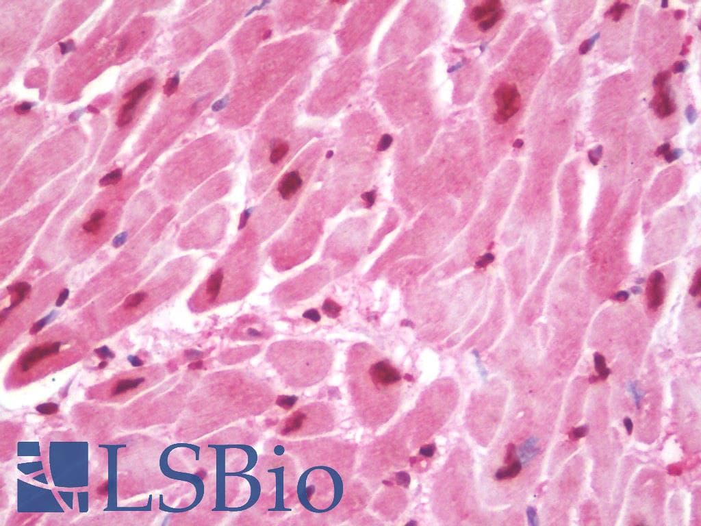IHC-plus™ Monoclonal Mouse anti-Human DAPK2 / DAP Kinase 2 Antibody (clone 1B5, IHC, IF, WB)