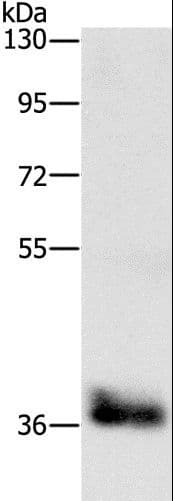 Polyclonal Rabbit anti-Human C/EBP Epsilon / CEBPE Antibody (WB)