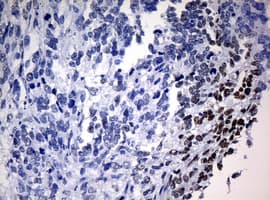 NBN / Nibrin Antibody (clone OTI3A9)