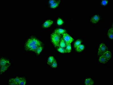 Polyclonal Rabbit anti-Human ADH1A / Alcohol Dehydrogenase Antibody (IHC)