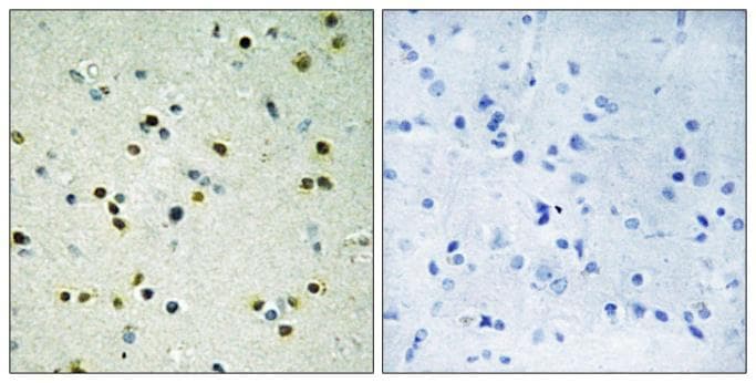KDM4B / JMJD2B Antibody