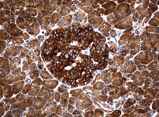 NME1 / NM23 Antibody (clone UMAB94)
