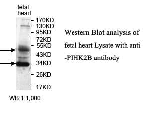 PIP4K2B Antibody (aa274-521)