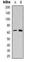 Polyclonal Rabbit anti-Human CSGALNACT2 Antibody (Internal, IHC, WB)
