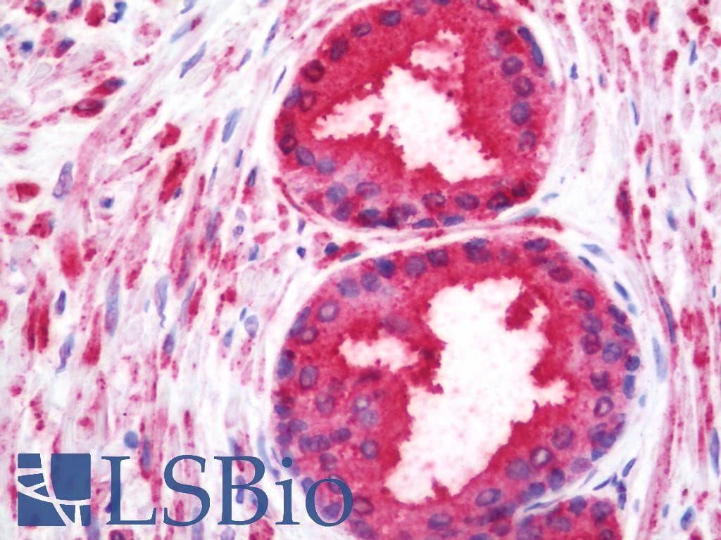IHC-plus™ WNT10A Antibody (Internal)