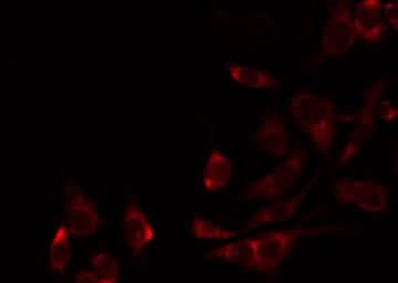 AASS / LKR / SDH Antibody