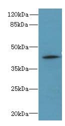 ZNF193 Antibody