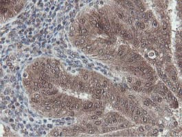 OTUB1 / OTU1 Antibody (clone OTI5B8)