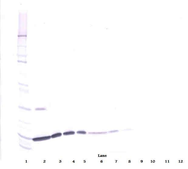IHC-plus™ Polyclonal Goat anti-Human IL2 Antibody (IHC, WB)