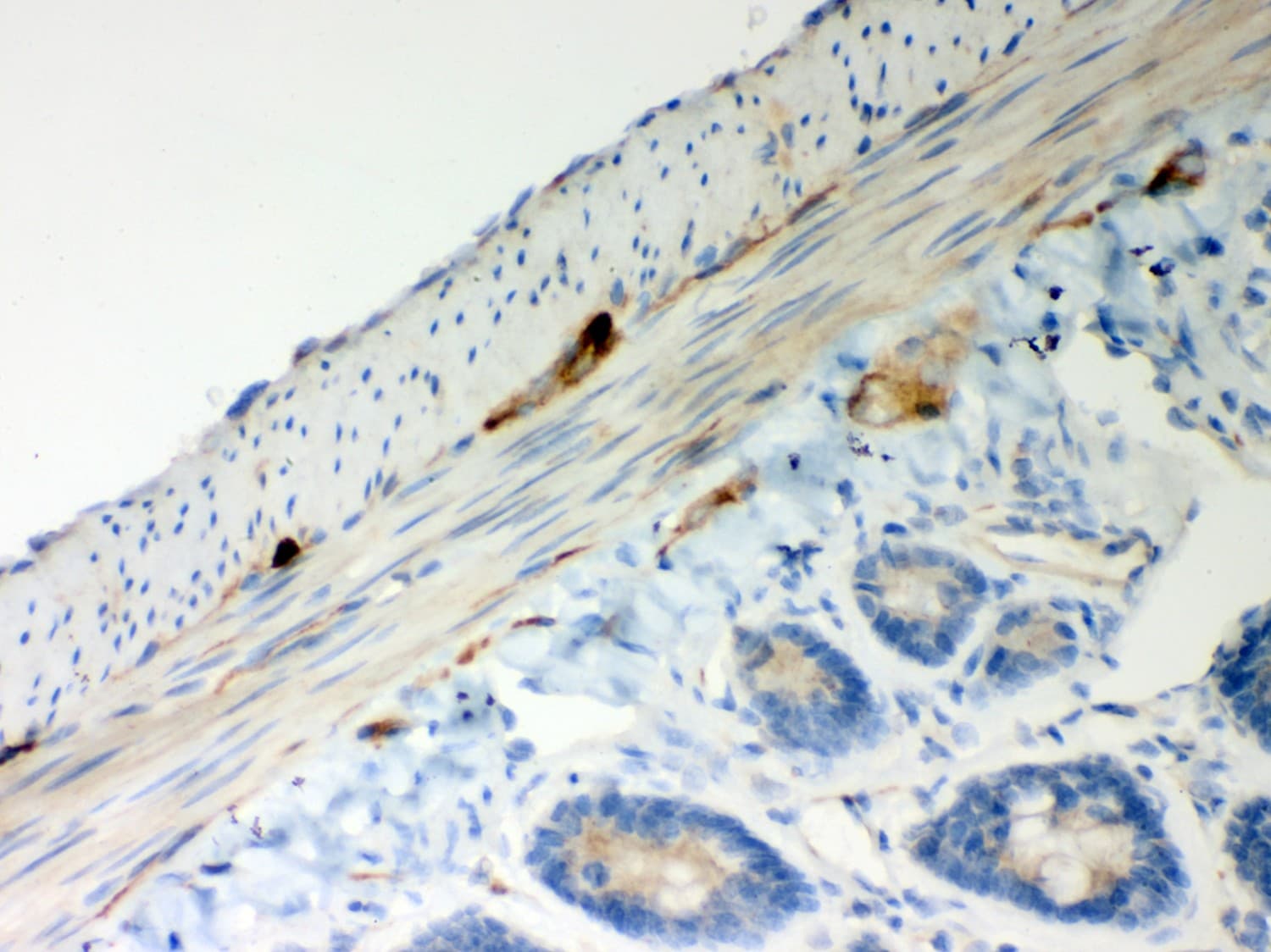 ATP5H Antibody (aa2-161)