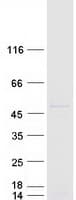 Human ELP4 Protein (Recombinant Myc-DDK (Flag))