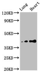 Polyclonal Rabbit anti-Human TUSC3 Antibody (IHC, WB)