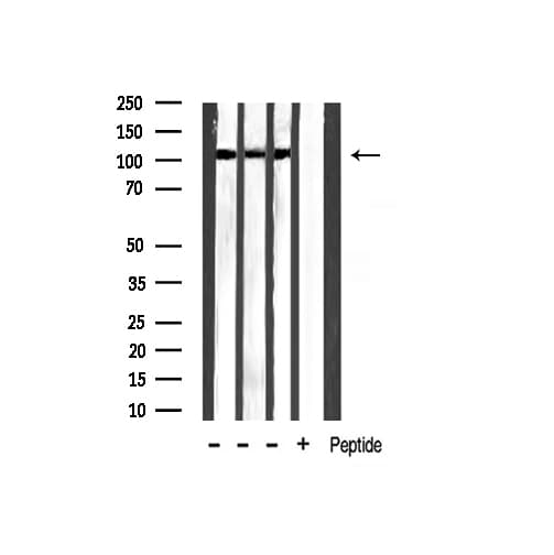 HDAC5 Antibody (phospho-Ser259)