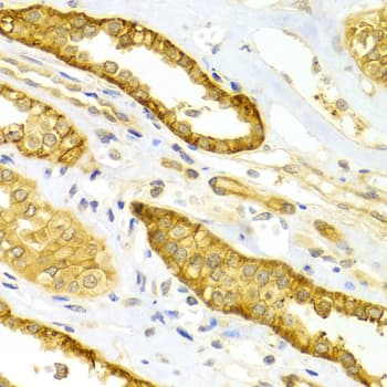 SELE / CD62E / E-selectin Antibody