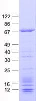 Human CDY2B Protein (Recombinant His, N-Terminal)