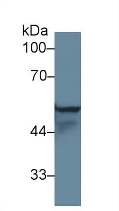 KRT4 / CK4 / Cytokeratin 4 Antibody (aa317-454, Biotin)